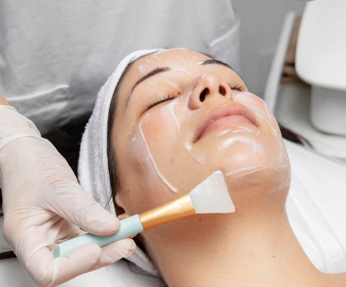 Chemical Peel Treatment in Kokapet, Hyderabad