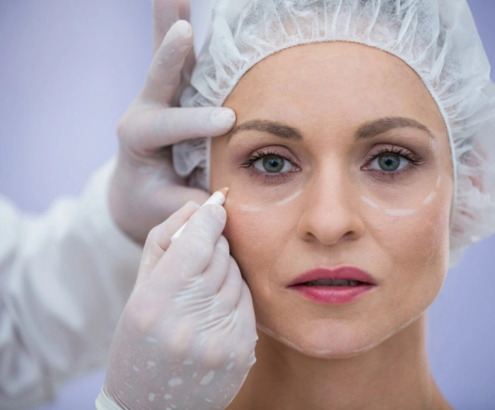 Morpheus8 Treatment in Hyderabad