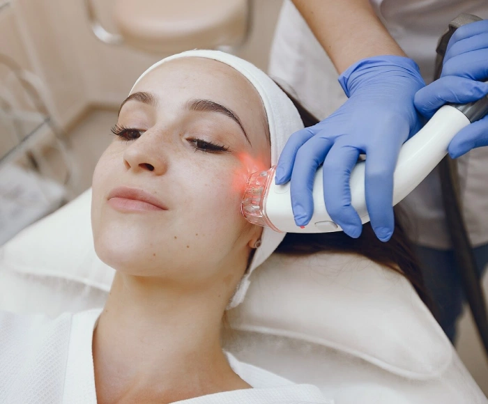 Laser Skin Toning in Hyderabad