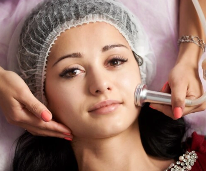 Exosome Skin Treatment in Hyderabad