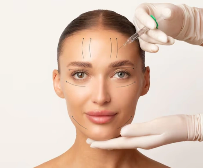 Thread Lift Treatment in Hyderabad