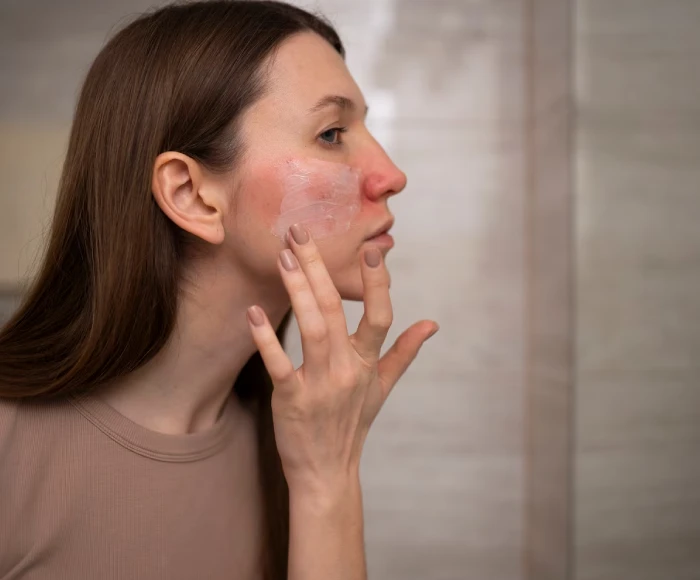 Skin Problems Hyderabad's Climate Causes